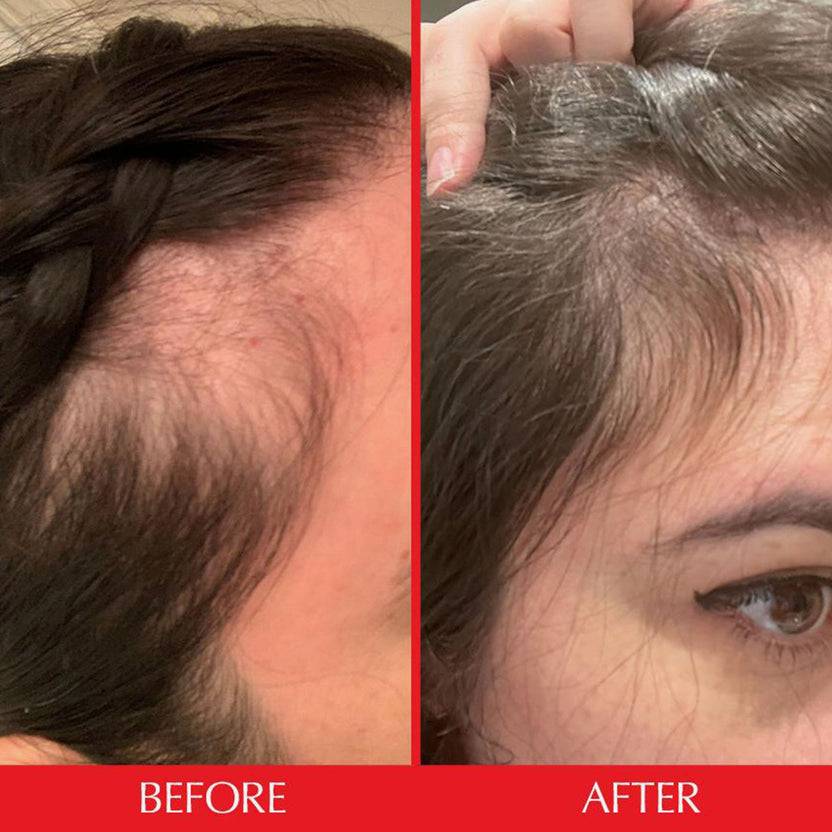 HAIRtamin Gummy Stars™ 3 Month Bundle