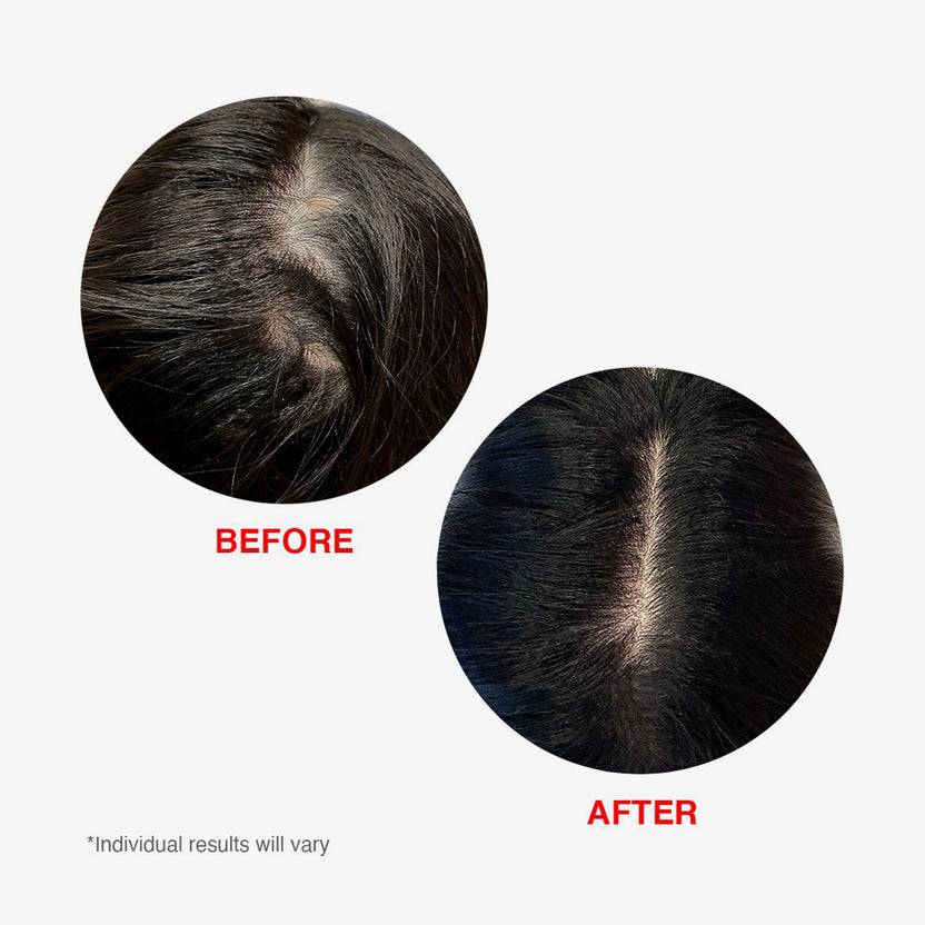 HAIRtamin Scalp Serum (60ml)