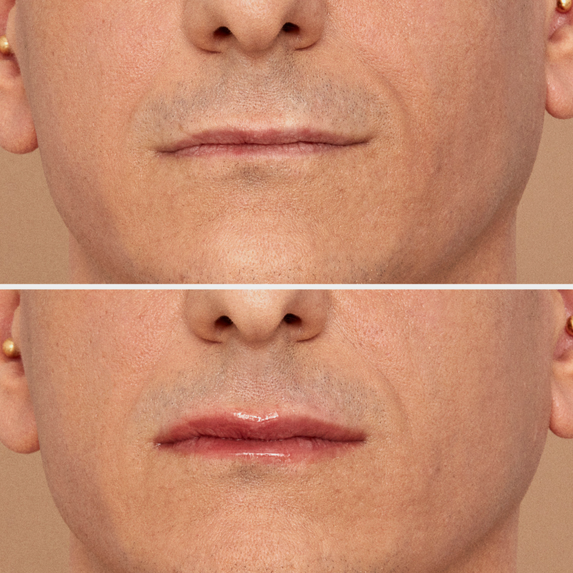 NABLA Cosmetics Lip Plumper - Viper (4ml)