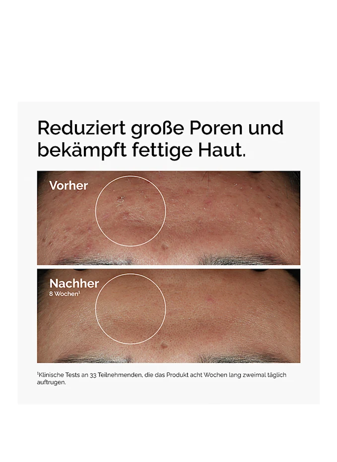 The Ordinary. The Ordinary. NIACINAMIDE 10% + ZINC 1%Serum