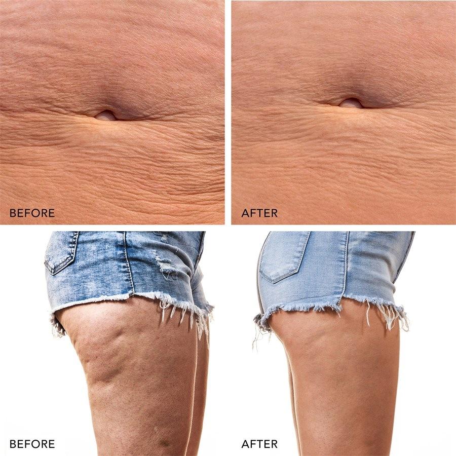 Body Lavender Von Foreo