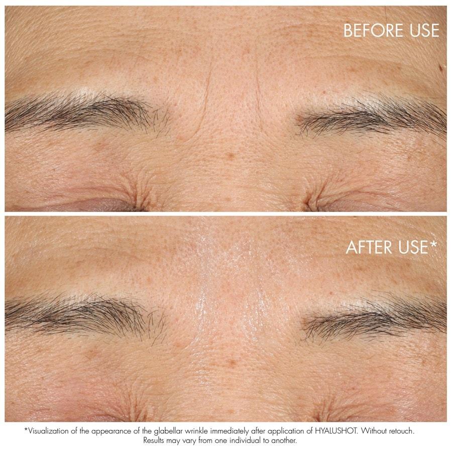 Capture Totale Hyalushot Von DIOR