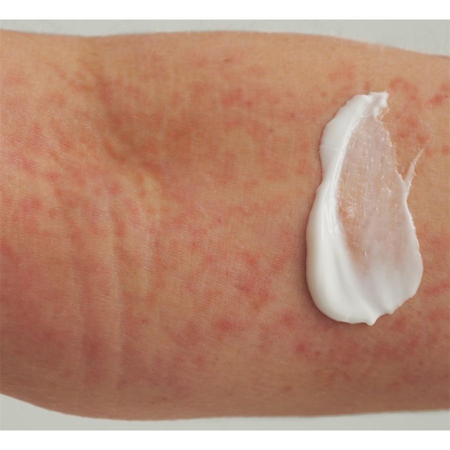 EXTRODERM DUSCHCREME - Bei Trockener Haut Und Neurodermitis Von DADO SENS