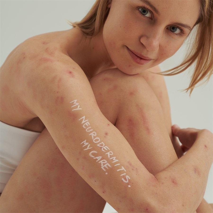 EXTRODERM SHAMPOO - Bei Trockener Haut Und Neurodermitis Von DADO SENS