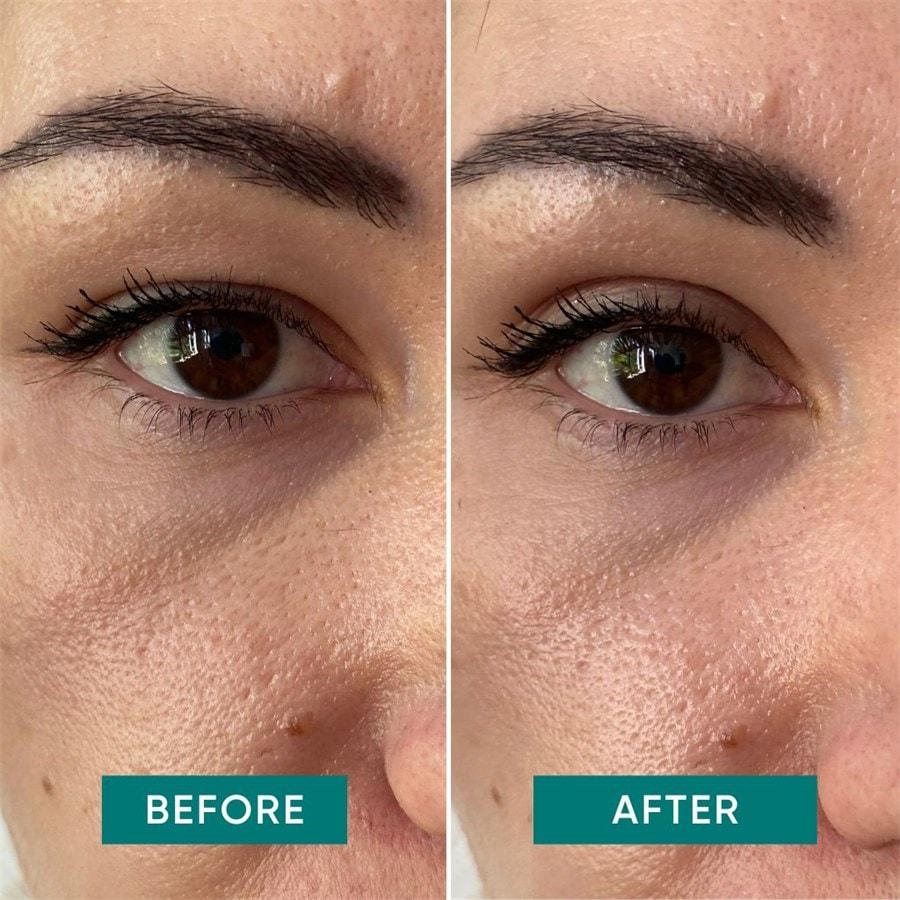 Gesicht Eyelid Lifting Tapes Von APRICOT