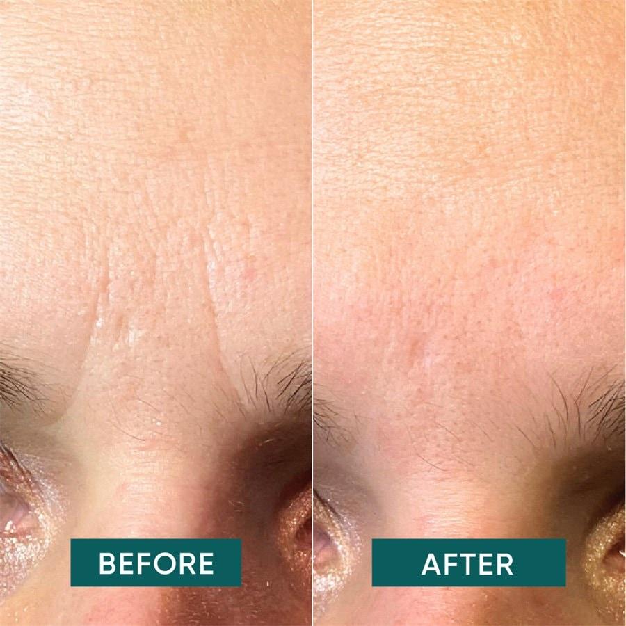 Gesicht Facial Patches Aloe Vera - Aloe You Vera Much Von APRICOT