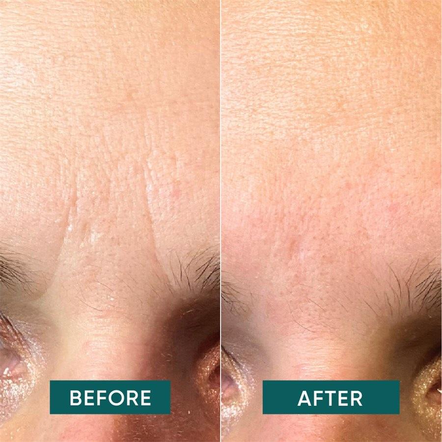 Gesicht Patches - Down The Frown Von APRICOT