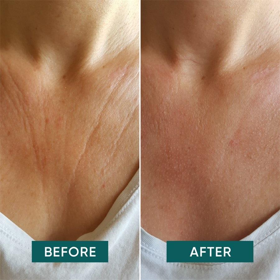 Körper Decolleté Pad Mit Vitamin C - Décolleté Delight Von APRICOT