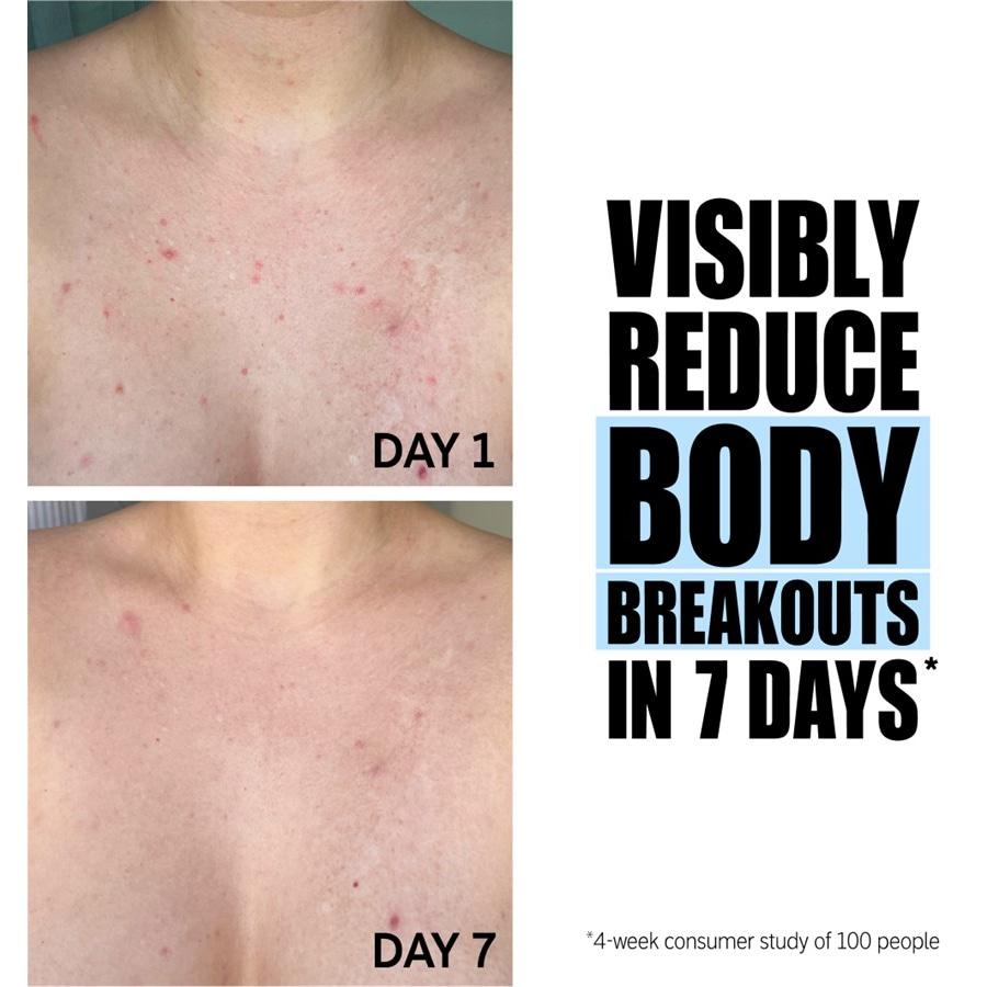 Peeling Glycolic Acid Exfoliating Body Stick Von The INKEY List