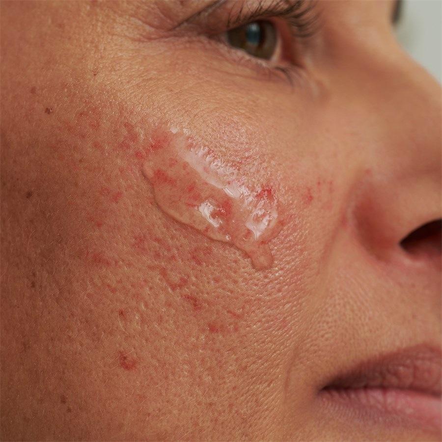 SENSACEA REINIGUNGSGEL - Bei Hypersensibler Haut & Couperose Von DADO SENS