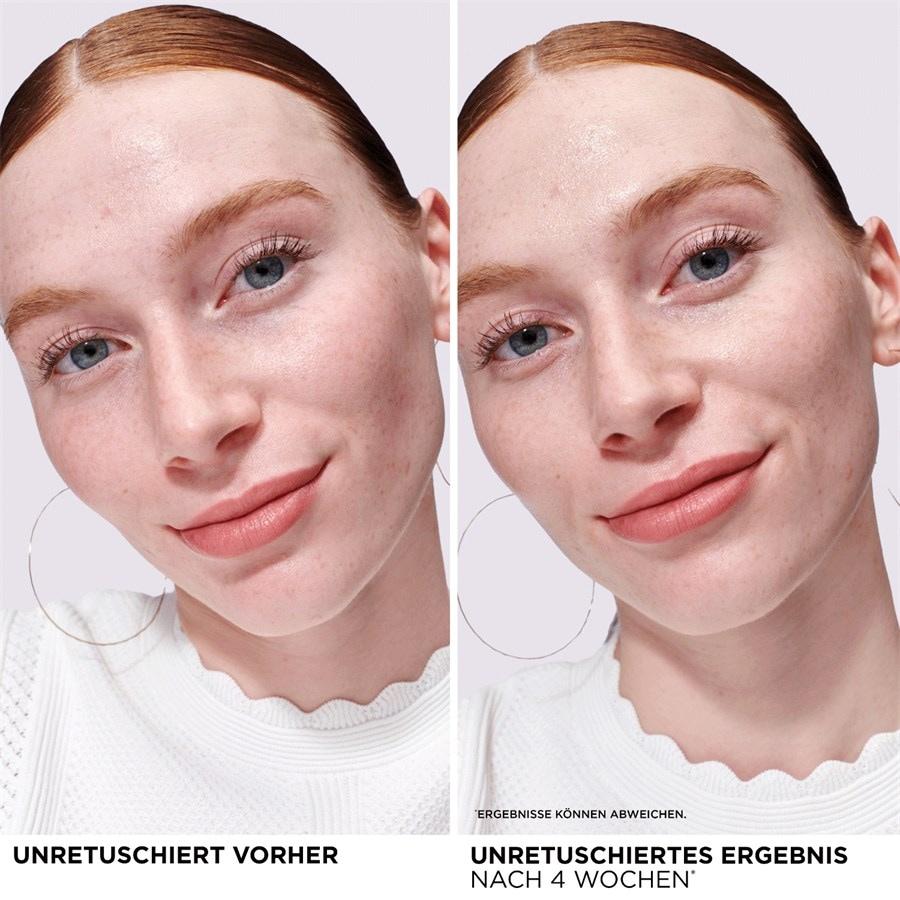 Seren Bye Bye Redness Serum Von It Cosmetics