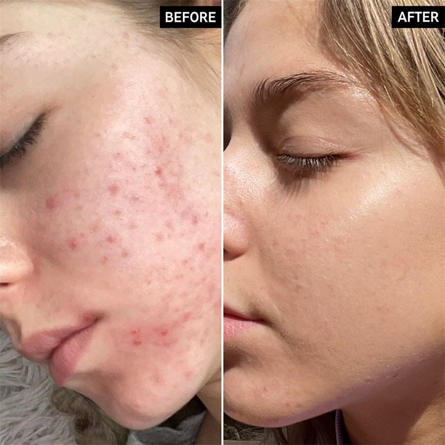 Seren Niacinamide Serum Von The INKEY List