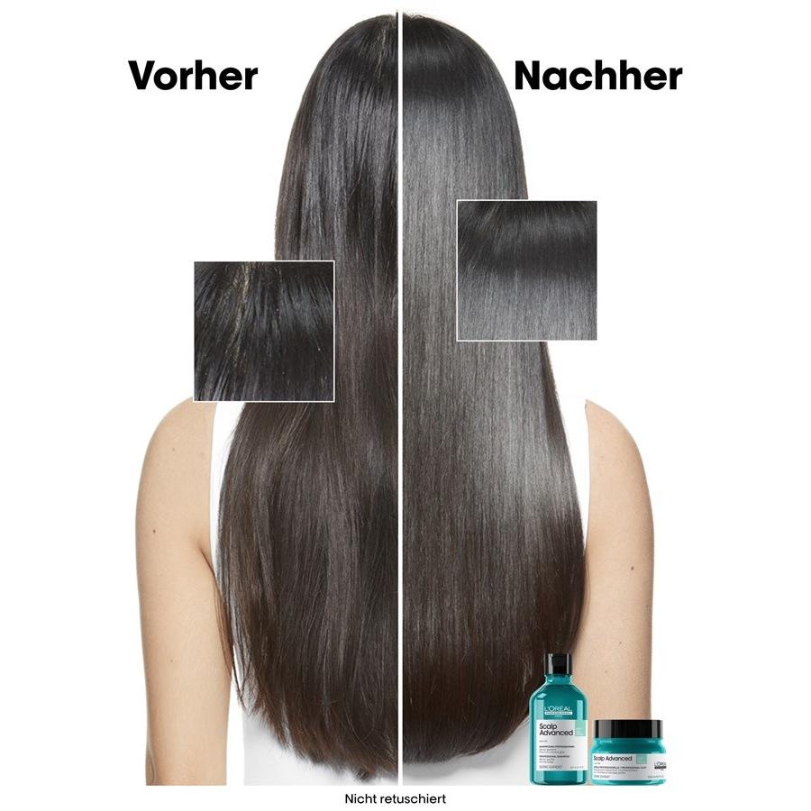 Serie Expert Scalp Advanced Anti-Oiliness 2in1 Deep Purifier Clay Von L’Oréal Professionnel Paris