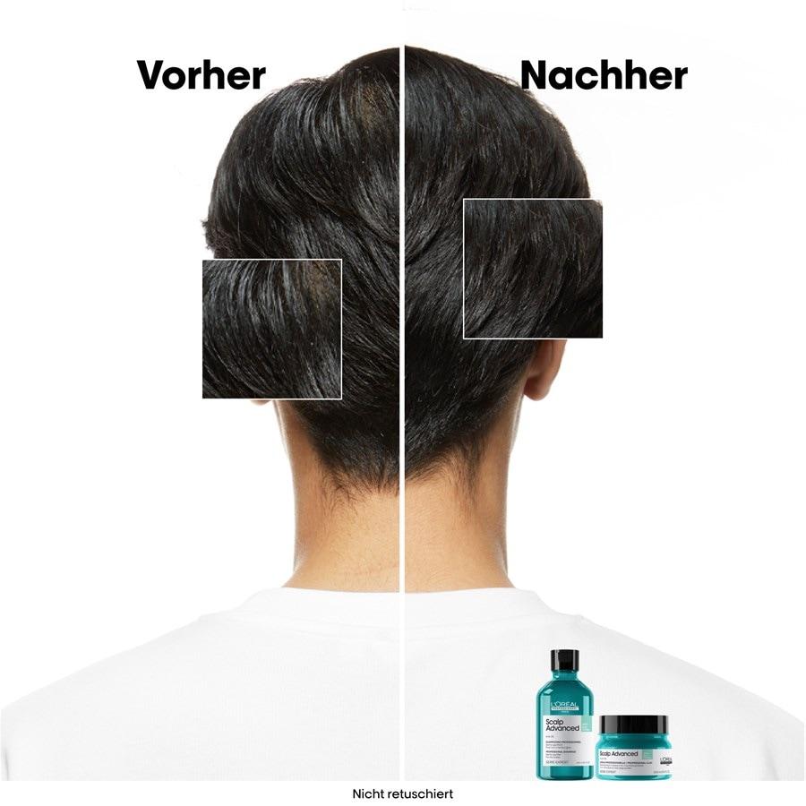 Serie Expert Scalp Advanced Anti-Oiliness 2in1 Deep Purifier Clay Von L’Oréal Professionnel Paris
