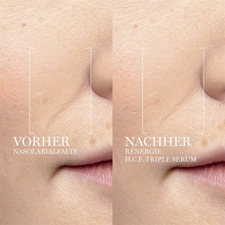 Serum Rénergie H.C.F. Triple Serum Von Lancôme