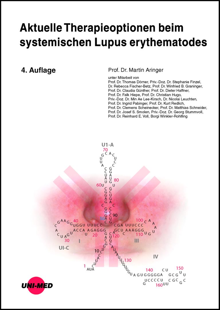 shopapotheke Aktuelle Therapieoptionen beim systemischen Lupus erythematodes