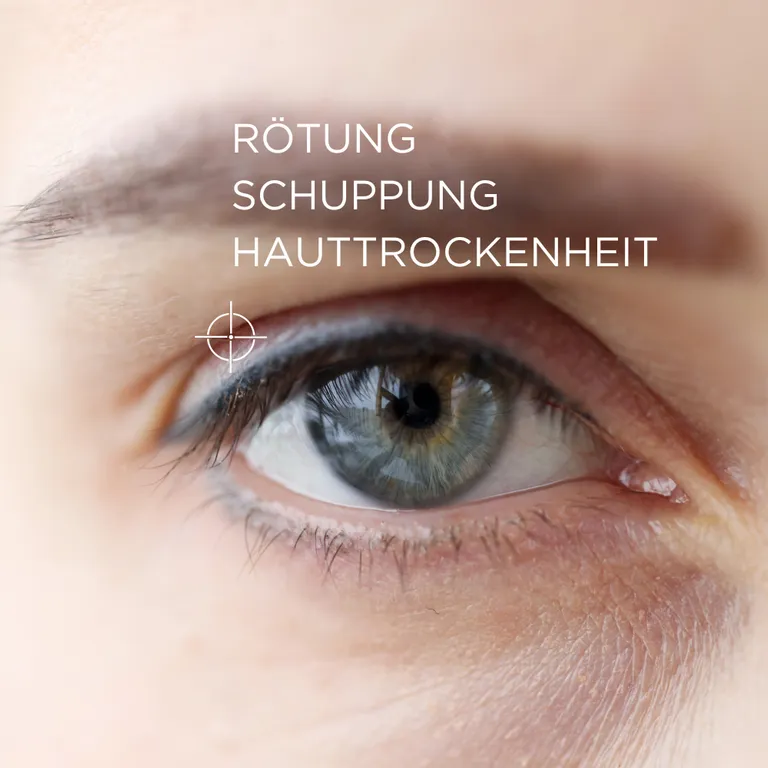 Shopapotheke ALLERGIKA® Augenlidcreme MED - Jetzt 2€ Sparen Mit Code "allmed2"