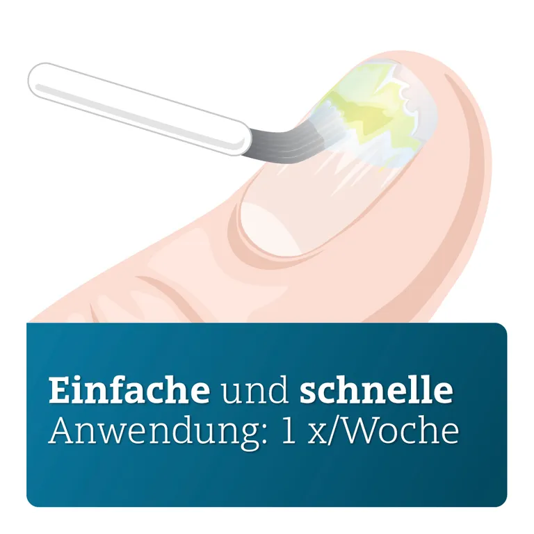 Shopapotheke AMOROLFIN ADGC® Wirkstoffhaltiger Nagellack Gegen Nagelpilz Inkl. Set