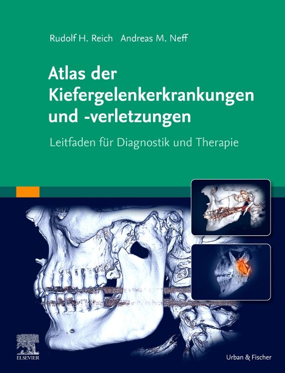 shopapotheke Atlas der Kiefergelenkerkrankungen und -verletzungen