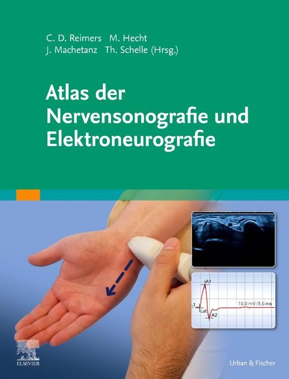 shopapotheke Atlas der Nervensonografie und Elektroneurografie