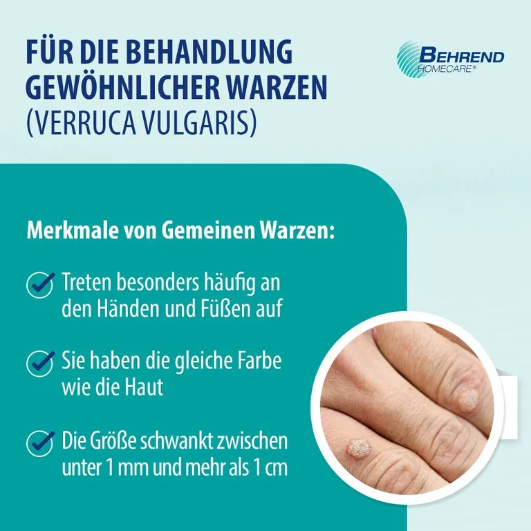Shopapotheke Behrend Warzenmittel Für Hand & Fuß - Effektive Warzen Verätzung Ohne Schmerzen - Hygienisch & Sicher