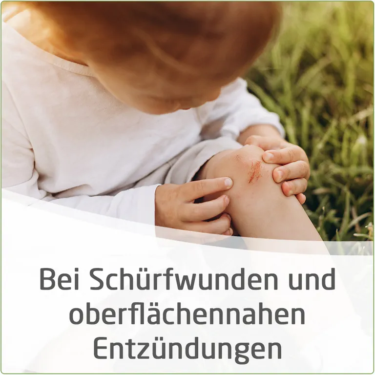 Shopapotheke Calendula Wundsalbe Zur Wirksamen Behandlung Von Schürfwunden Und Kleineren Hautverletzungen