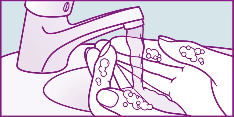 Shopapotheke Compeed® Herpes Bläschen Patches Doppelpack