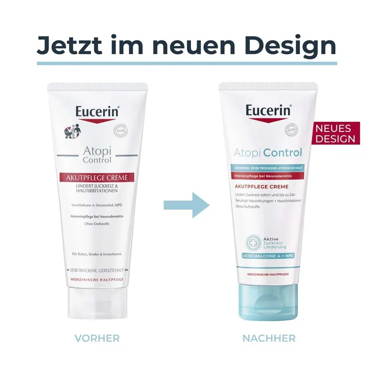 Shopapotheke Eucerin® AtopiControl Akutpflege Creme Hilft Wirksam Bei Akuten Neurodermitisschüben Gegen Juckreiz Hautrötungen Und Entzündungen - Jetzt 20% Sparen Mit Code "eucerin20" + Eucerin AtopiControl Hydro-Lotion 20ml