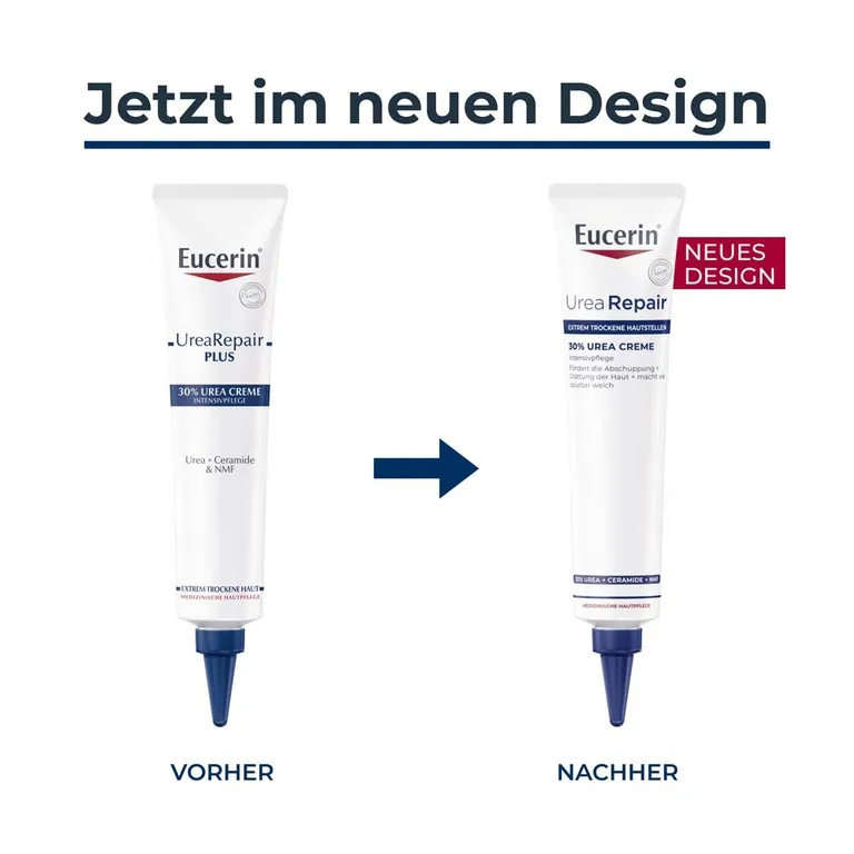 Shopapotheke Eucerin® UreaRepair 30% Urea Creme – Hautpflege Reduizert Verdickte Und Schuppende Haut - Jetzt 20% Sparen Mit Code "eucerin20" + Eucerin AtopiControl Hydro-Lotion 20ml GRATIS