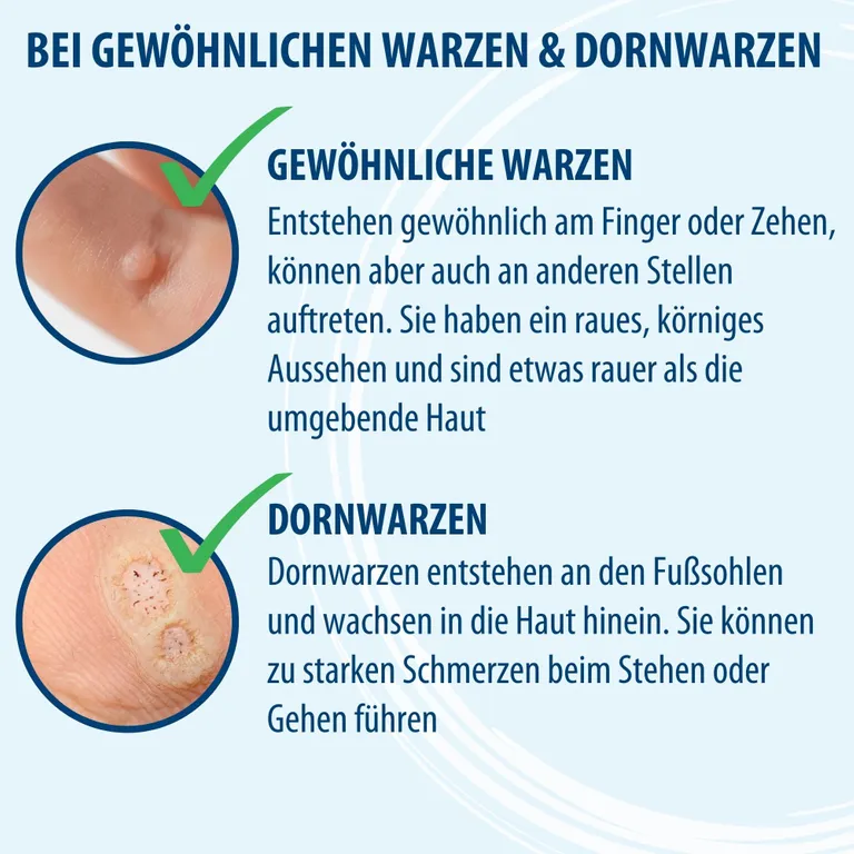 Shopapotheke Evolsin – Anti Warzen Stift Gegen Dornwarzen & Gewöhnliche An Füßen Händen Körper Armen & Beinen – Warzenstift Präzise Hygienisch & Sicher