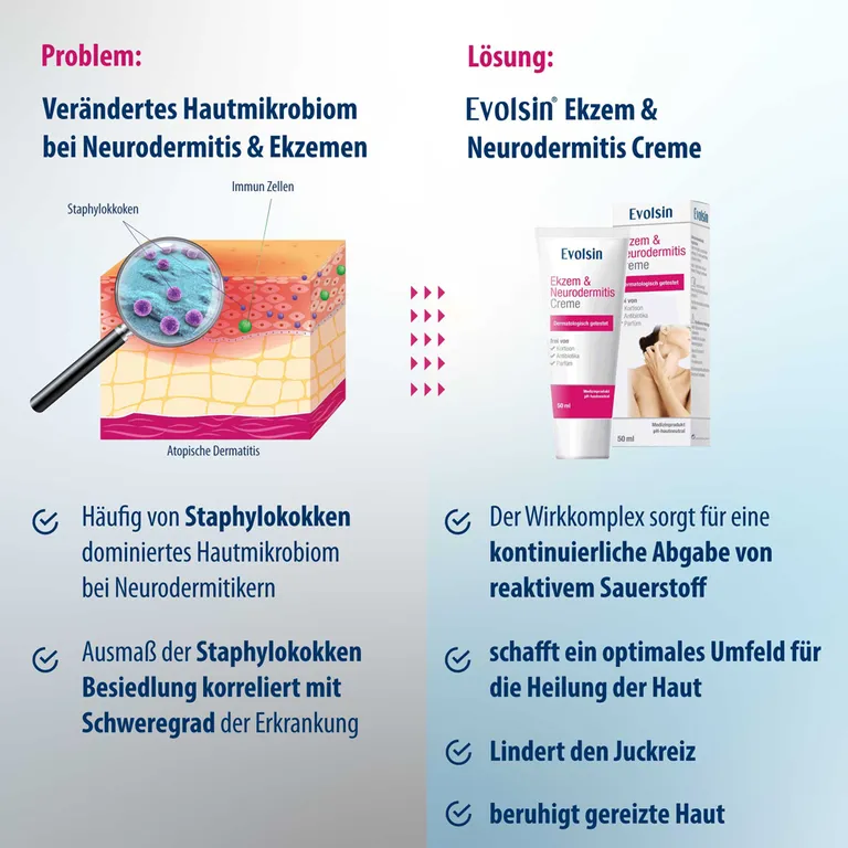 Shopapotheke Evolsin® Ekzem & Neurodermitis Creme - Mindert Juckreiz & Beruhigt Gereizte Haut - OHNE KORTISON - Salbe Für Gereizte Trockene & Irritierte Haut