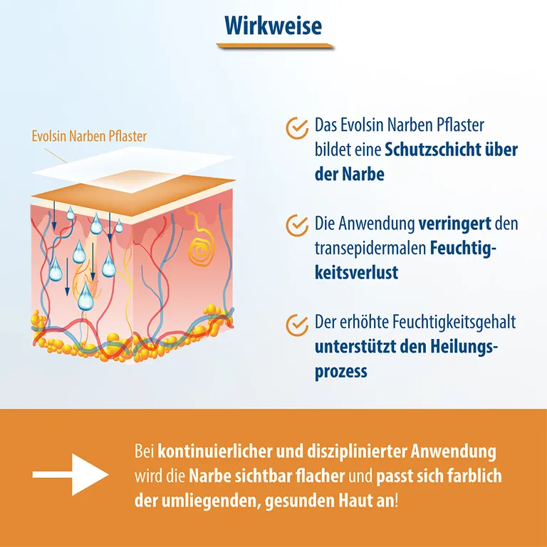 Shopapotheke Evolsin® Transparentes Narbenpflaster – Für Narben Aller Art – Narbenpflaster Aus Silikon Reduziert Sichtbar Narben - Für Eine Einfache Behandlung (200 Cm)