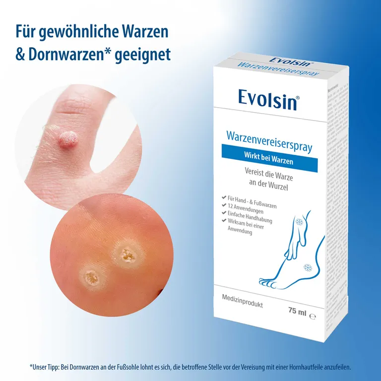 Shopapotheke Evolsin® Warzenvereiser – Entfernung Von Warzen Und Dornwarzen Sicher & Effektiv