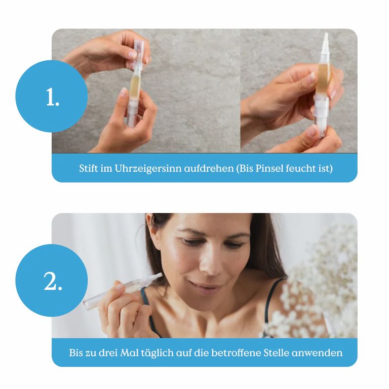 Shopapotheke Health Routine Wart Care Pen / Bei Warzen