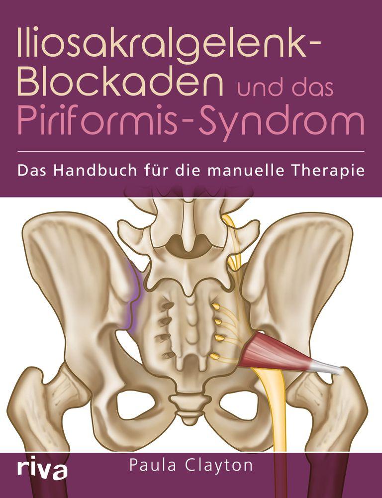 shopapotheke Iliosakralgelenk-Blockaden und das Piriformis-Syndrom shopapotheke Iliosakralgelenk-Blockaden und das Piriformis-Syndrom