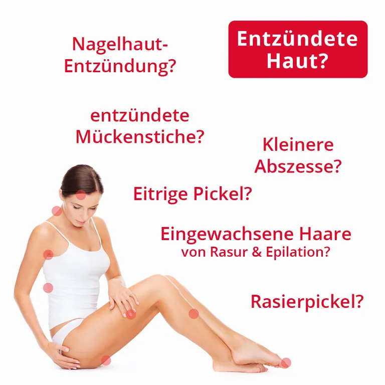 Shopapotheke Ilon® Salbe Classic Bei Entzündungen Der Haut