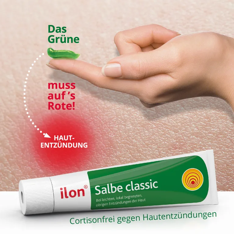 Shopapotheke Ilon® Salbe Classic Bei Entzündungen Der Haut