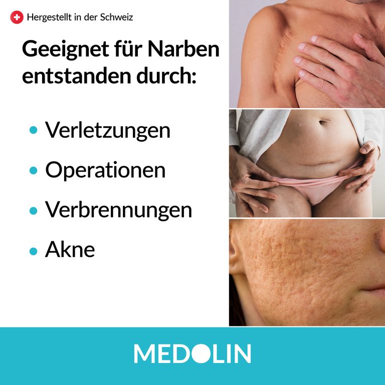 Shopapotheke Medolin® Narbengel - Narbensalbe Reduziert Die Sichtbarkeit Von Narben - Effektive Narbencreme