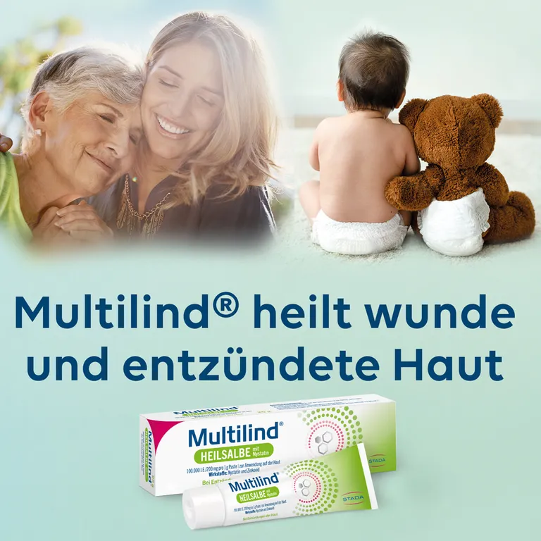 Shopapotheke Multilind® Heilsalbe Bei Wunder Und Entzündeter Haut Mit Zinkoxid Und Nystatin - Jetzt 20% Mit Dem Code Stada20 Sparen*