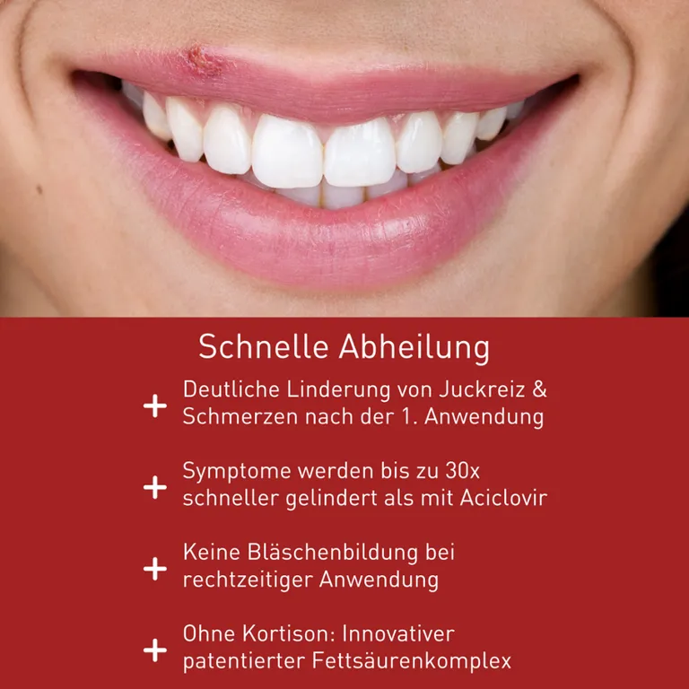 Shopapotheke N1 Herpes Creme Mit Soforteffekt . Innovativer Fettsäurenkomplex