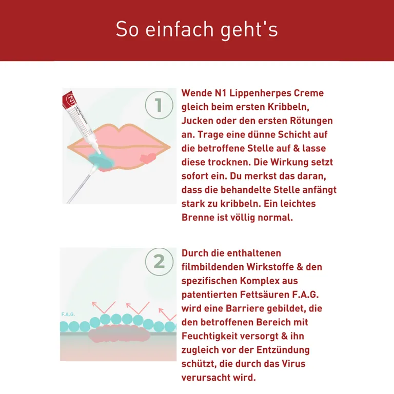 Shopapotheke N1 Herpes Creme Mit Soforteffekt . Innovativer Fettsäurenkomplex
