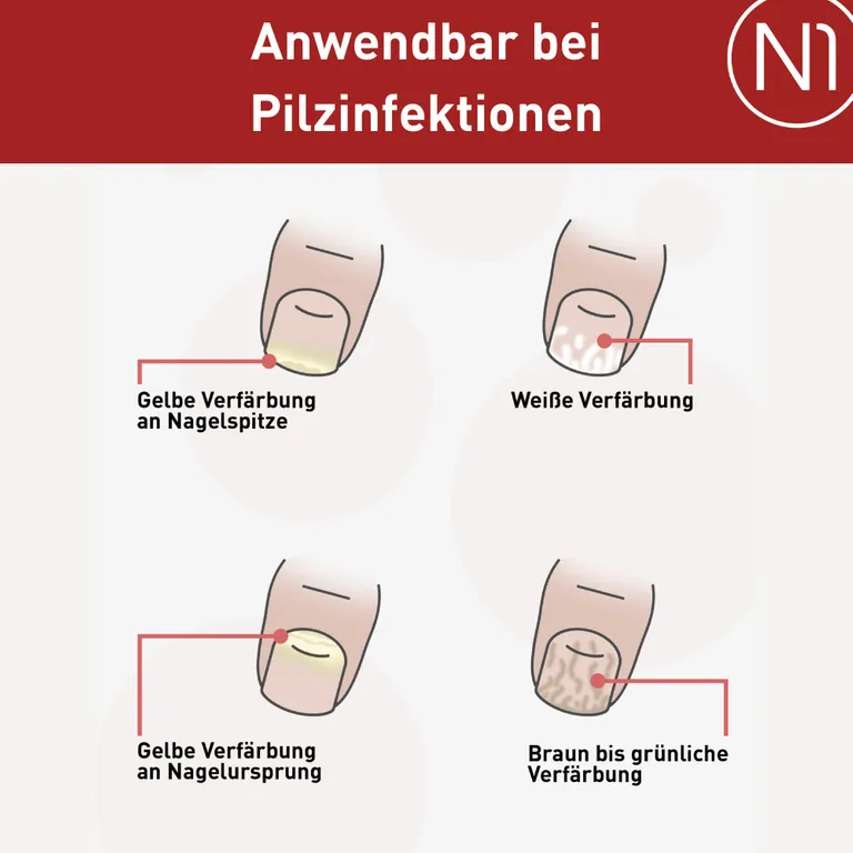 Shopapotheke N1 Nagelpilz Lösung Effektive Monatskur