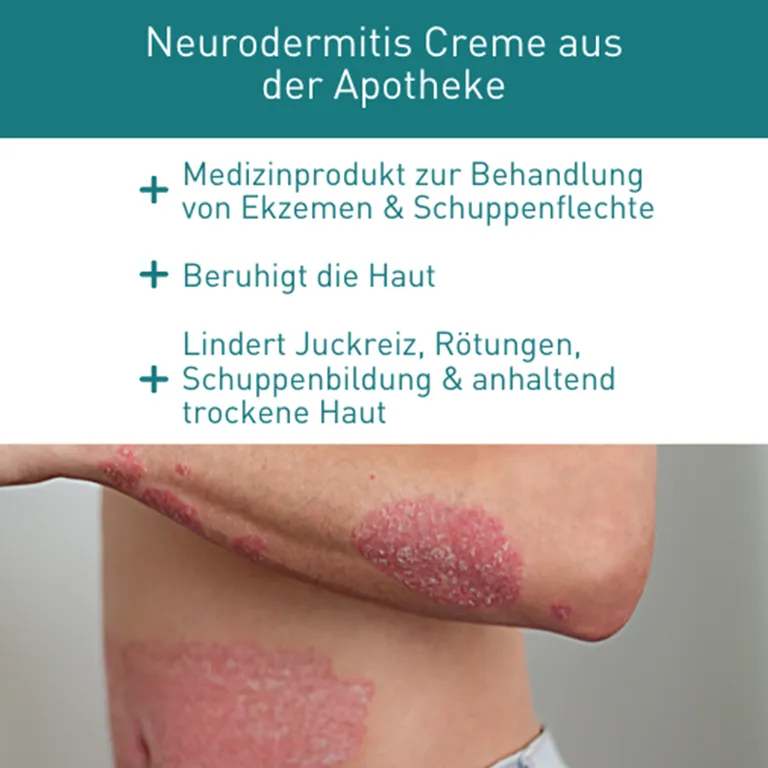 Shopapotheke N1 Psoriasis & Neurodermitis Intensivcreme