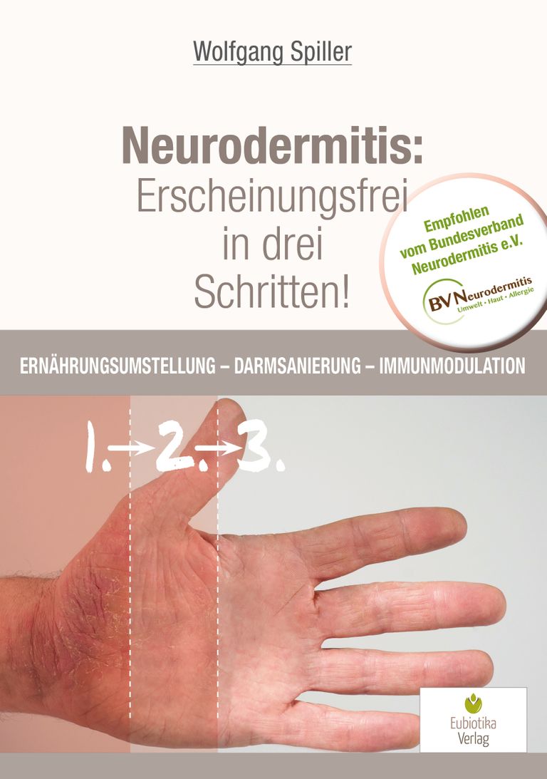 shopapotheke Neurodermitis: Erscheinungsfrei in drei Schritten