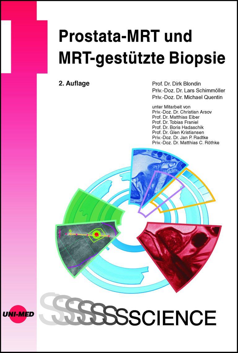 shopapotheke Prostata-MRT und MRT-gestützte Biopsie