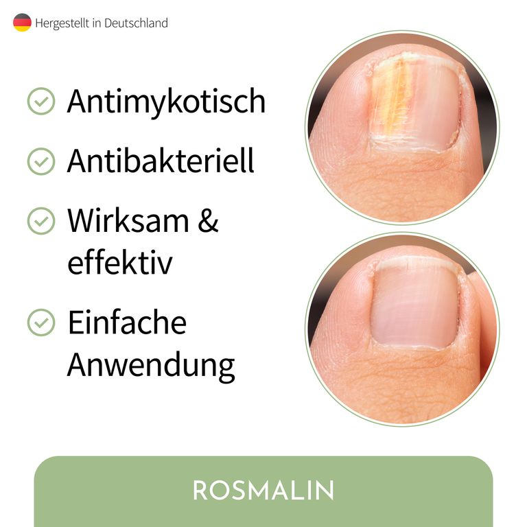 Shopapotheke Rosmalin® Nail Care Pen - Nagelpilz Pflege