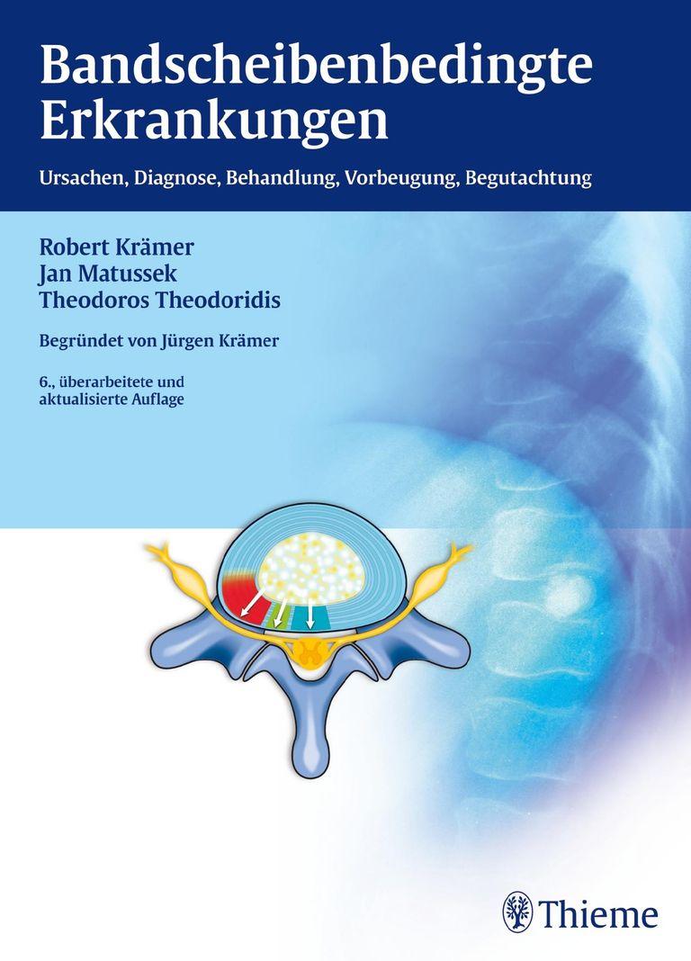 shopapotheke Bandscheibenbedingte Erkrankungen
