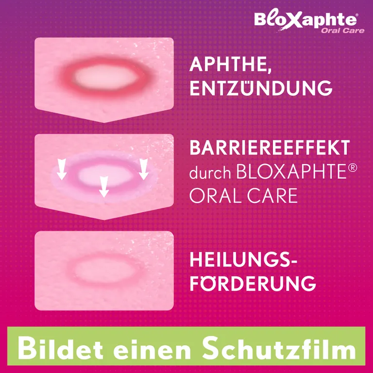 Shopapotheke BloXaphte® Oral Care Mund-Gel