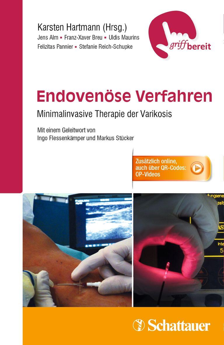 shopapotheke Endovenöse Verfahren