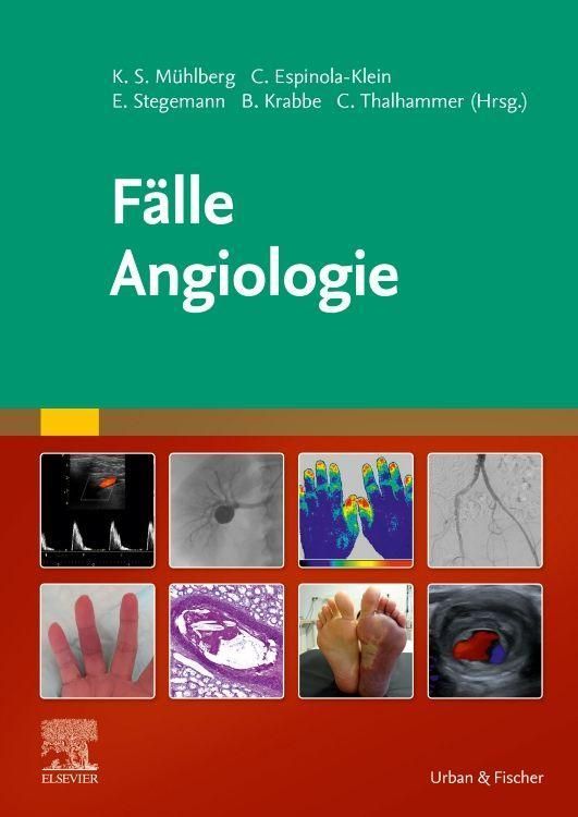 shopapotheke Fälle Angiologie